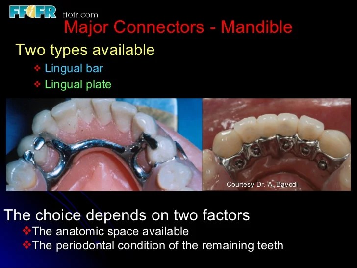 Connectors lingual